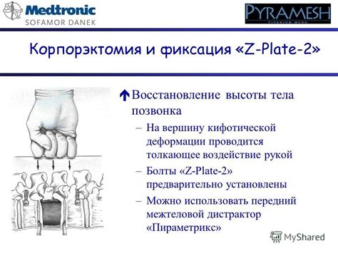 Как правильно использовать блок позвонка для максимальной эффективности