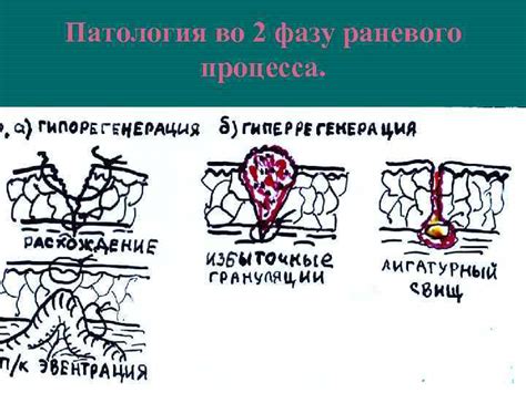 Как предотвратить гнойно-некротическую фазу раневого процесса