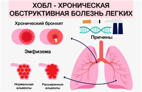 Как предотвратить развитие нео процесса в легких?