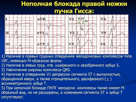 Как предотвратить развитие неполной блокады ПНПГ при ЭКГ у ребенка?