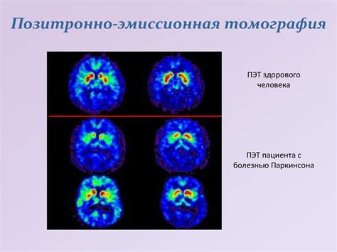 Как преодолеть отрицательное толкование сновидения о полноформатном теленке?