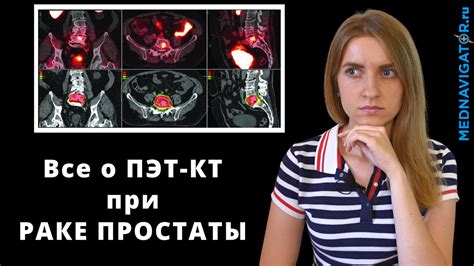 Как проводится КТ и что о нем можно узнать?