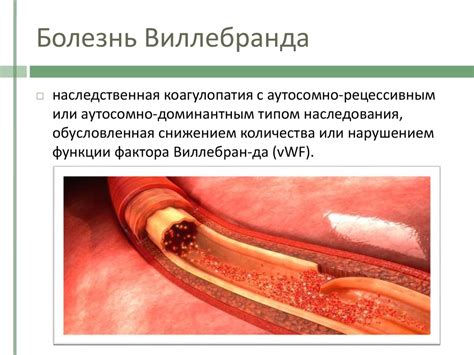 Как проводится диагностика Виллебранда болезни у женщин?