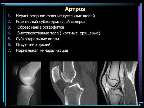 Как проводится диагностика суставных щелей?