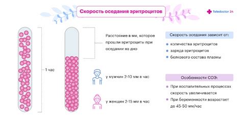 Как проводятся измерения СОЭ