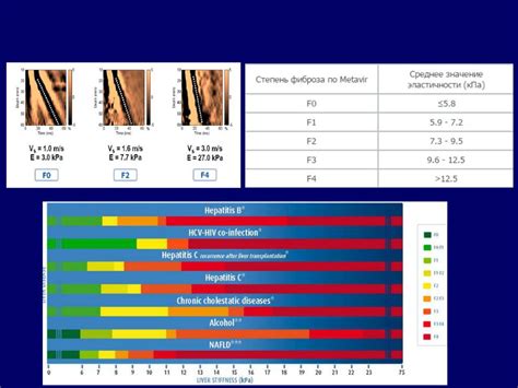 Как проводят и интерпретируют результаты непрямой эластометрии печени