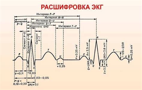 Как производится исследование кардиограммы