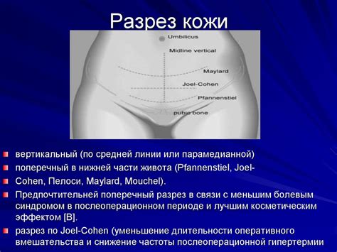 Как происходит абдоминальное родоразрешение