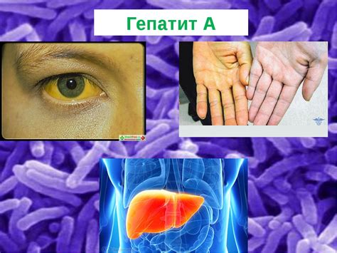 Как происходит диагностика гепатита А?