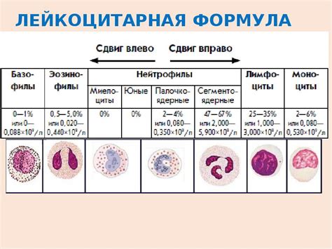 Как происходит сдвиг лейкоцитарной формулы?