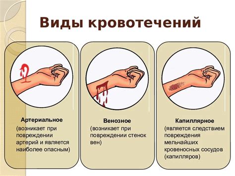 Как пустить кровь: методы и технологии