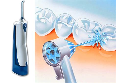 Как работает водный ирригатор для зубов?