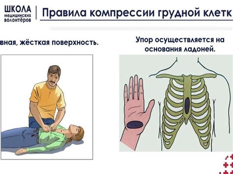 Как работает непрямой массаж сердца?