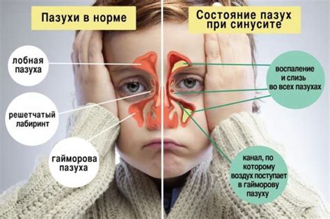 Как работают пневматизированные придаточные пазухи носа