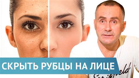 Как развивается рубец?