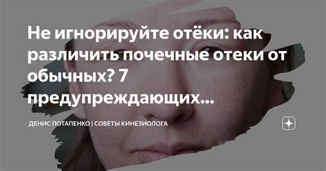 Как различить ясноглазую от обычной?