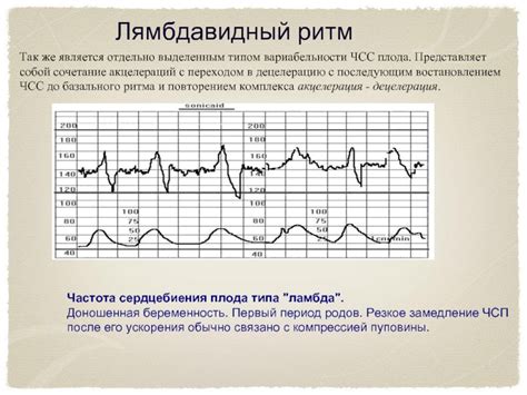 Как распознать децелерацию