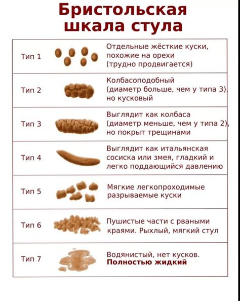 Как реагировать на желтый жидкий стул