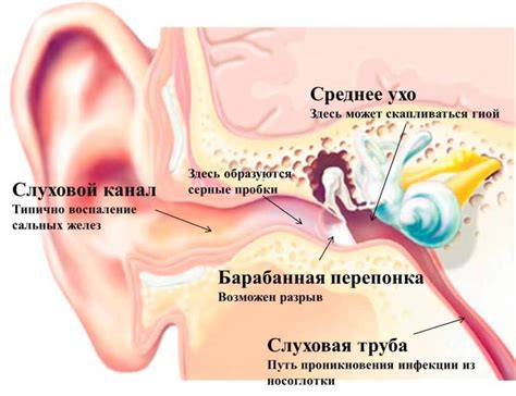 Как самостоятельно удалить воду из ушей и улучшить слух?