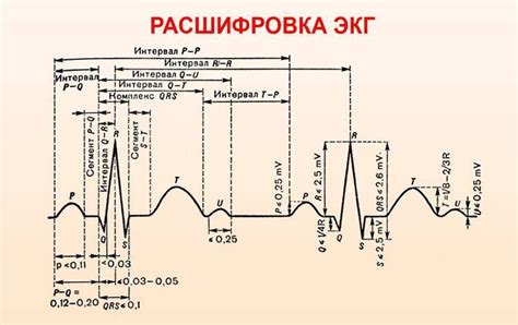 Как читать значения на кардиограмме?