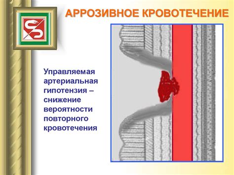 Кишечные кровотечения: основные факторы и влияние на организм