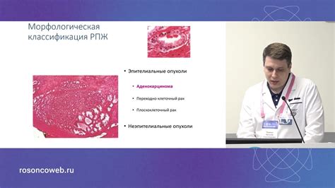 Классификация рака предстательной железы