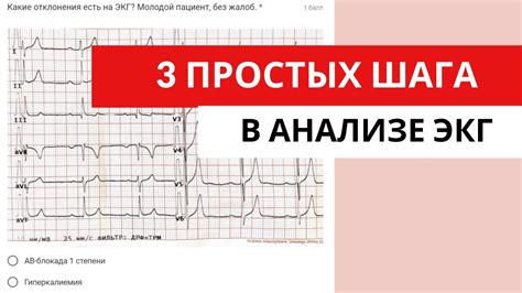 Когда возникает необходимость в анализе ненормальной огибающей ЭКГ?