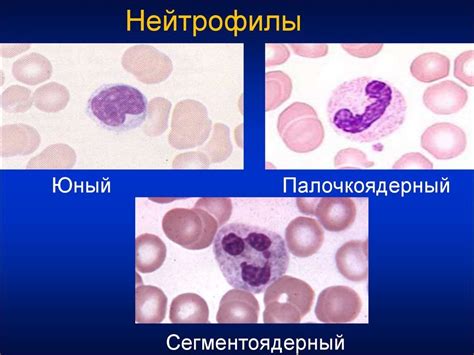 Когда нейтрофилы в крови ниже нормы