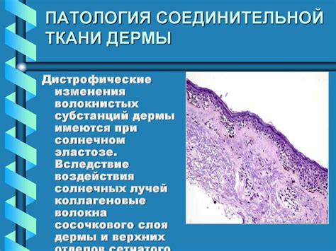 Коллаген - основа кожи и соединительной ткани