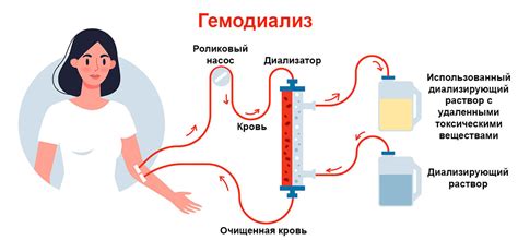 Кому показан гемодиализ почек?