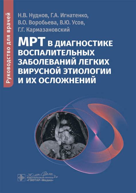 Корни тяжести и их значение при диагностике различных заболеваний легких