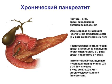 Косвенные признаки хронического панкреатита: