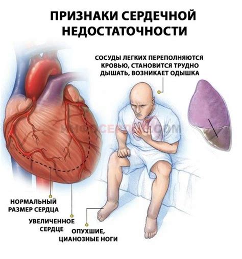 Костлявый – определение и причины