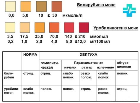 Лабораторный анализ уробилина в моче