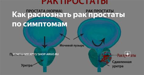 Латентное накопление железа у мужчин