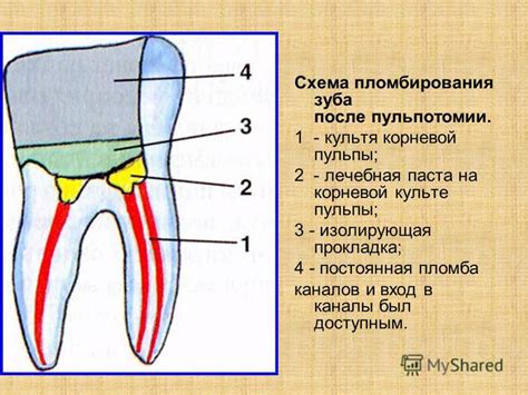 Лечебная пломба: определение