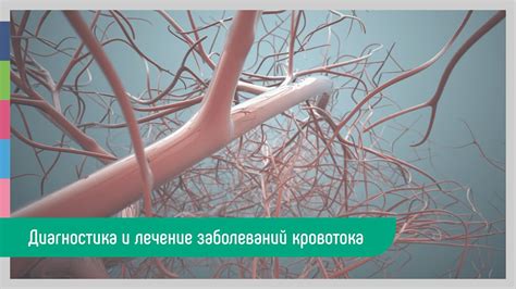 Лечение ЦДК перинодулярного кровотока: основные методы