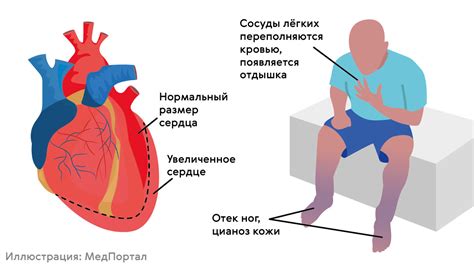 Лечение блокады сердца