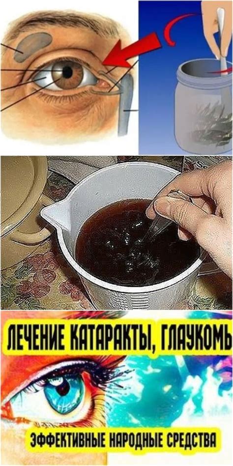 Лечение водянистых глаз дома