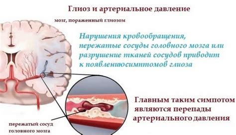 Лечение гиподенсивных очагов головного мозга