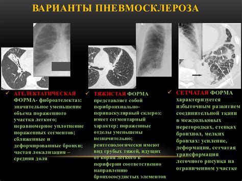 Лечение грубого фиброзного тяжа