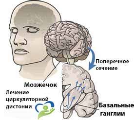 Лечение нейроциркуляторной дистонии