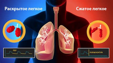 Лечение неполного раскрытия легких