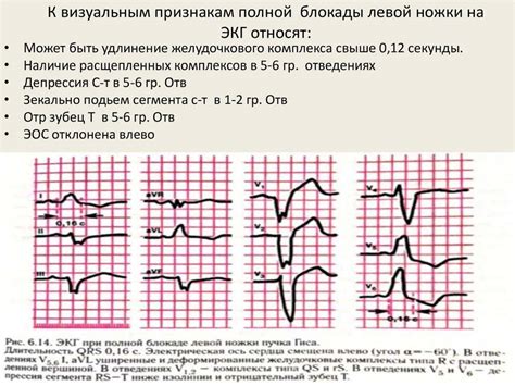 Лечение неполной блокады ПНПГ у детей