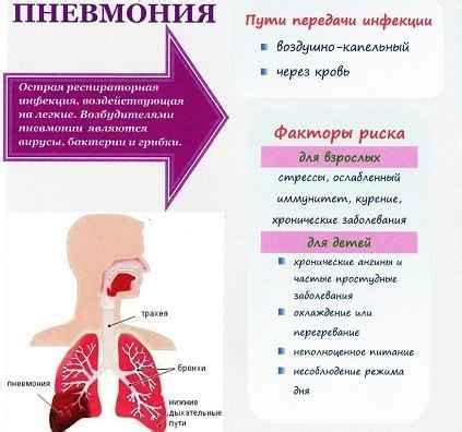 Лечение нижнедолевой пневмонии слева