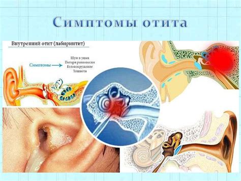 Лечение отита с перфорацией