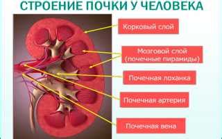 Лечение пиелокаликоэктазии