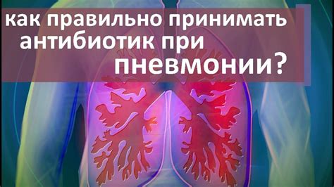 Лечение пневмонии в живот гепарином: преимущества и эффективность