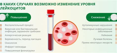 Лечение повышенных лейкоцитов: основные рекомендации