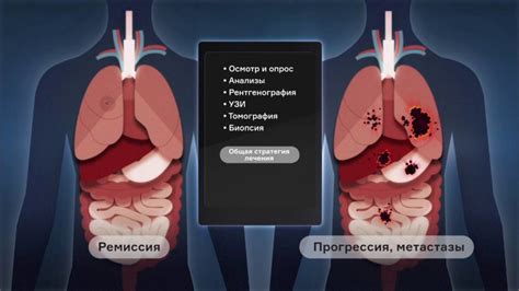 Лечение рака: операция и ремиссия